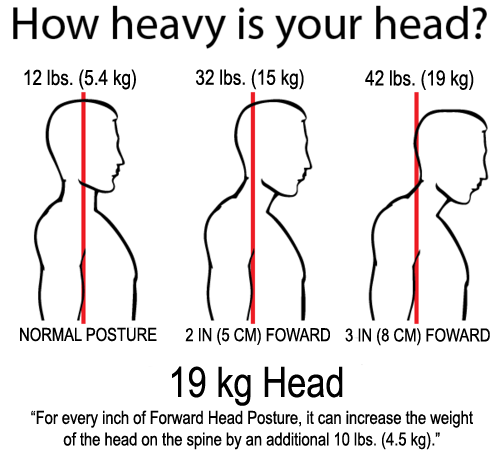 Image result for forward head posture and increased weight on spine