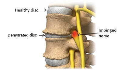 DehydratedDisc