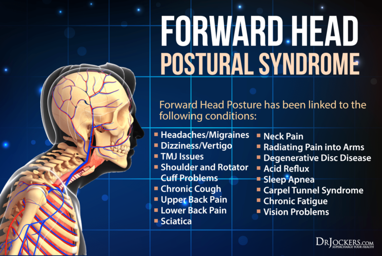FORWARDHEADPOSTURAL Syndrome