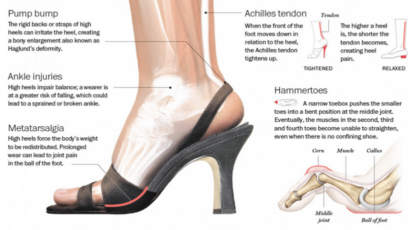 Image result for high heel posture