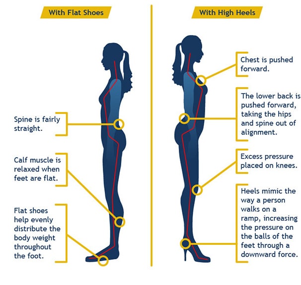 Image result for high heel posture